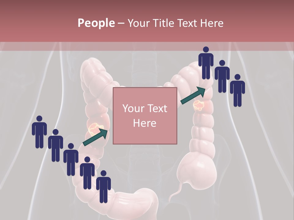 Vitals Digestive Tumor PowerPoint Template