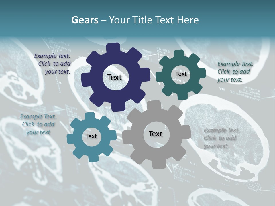Hospital Radiologist Emergency PowerPoint Template