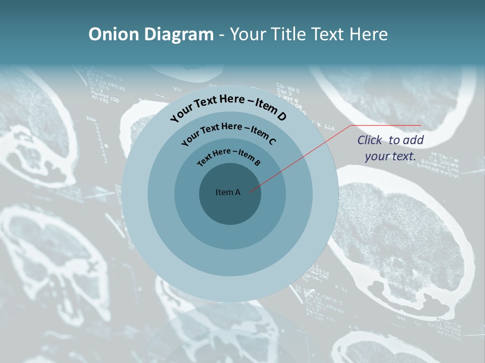 Hospital Radiologist Emergency PowerPoint Template