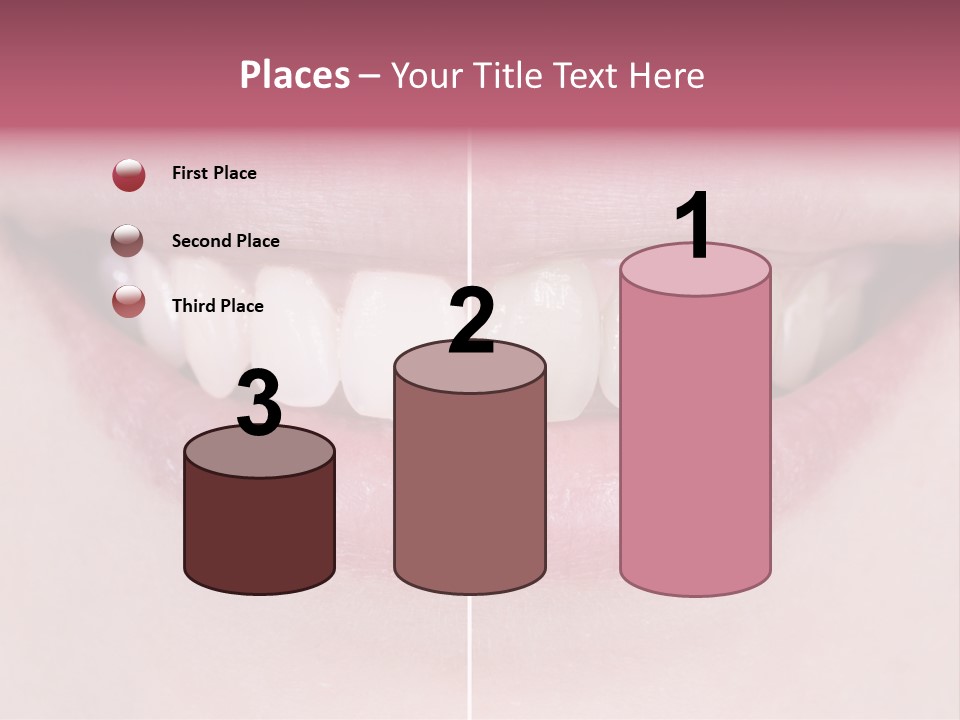 A Woman's Smile Before And After Dental Treatment PowerPoint Template