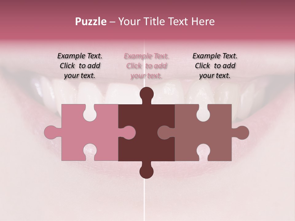 A Woman's Smile Before And After Dental Treatment PowerPoint Template