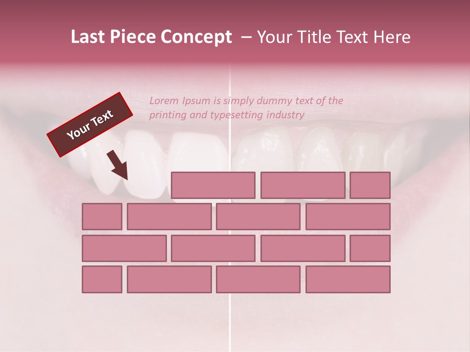 A Woman's Smile Before And After Dental Treatment PowerPoint Template