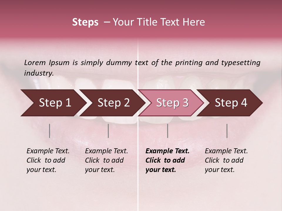 A Woman's Smile Before And After Dental Treatment PowerPoint Template