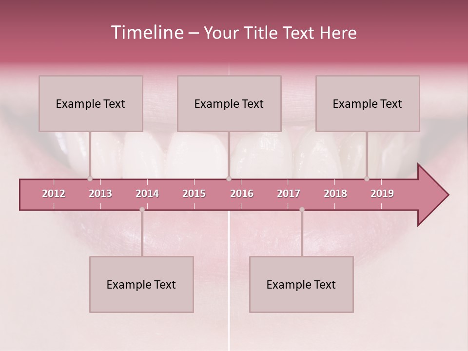 A Woman's Smile Before And After Dental Treatment PowerPoint Template