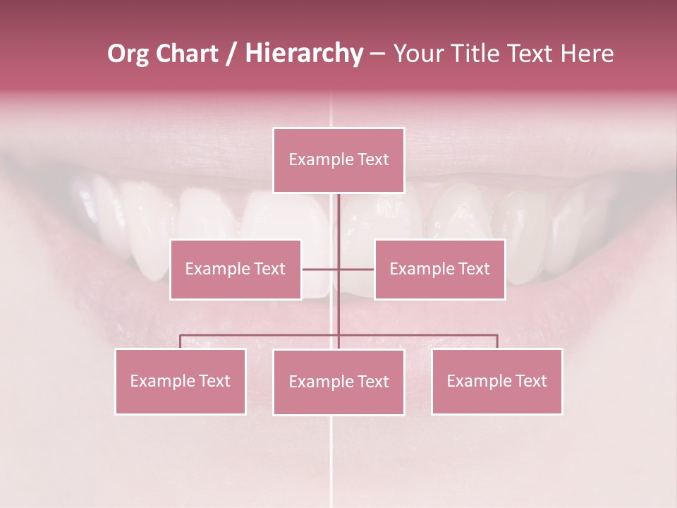 A Woman's Smile Before And After Dental Treatment PowerPoint Template