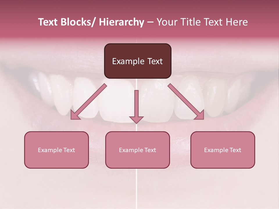 A Woman's Smile Before And After Dental Treatment PowerPoint Template