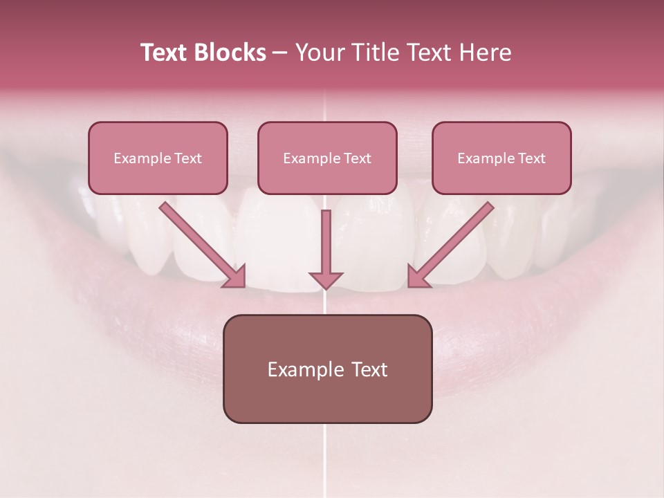 A Woman's Smile Before And After Dental Treatment PowerPoint Template