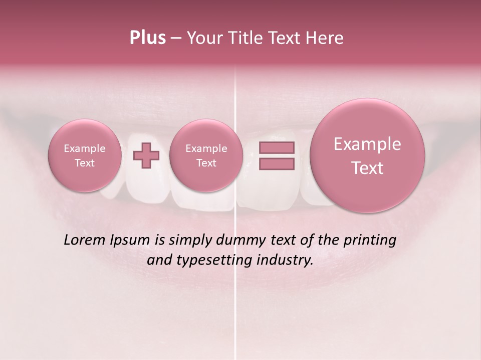 A Woman's Smile Before And After Dental Treatment PowerPoint Template