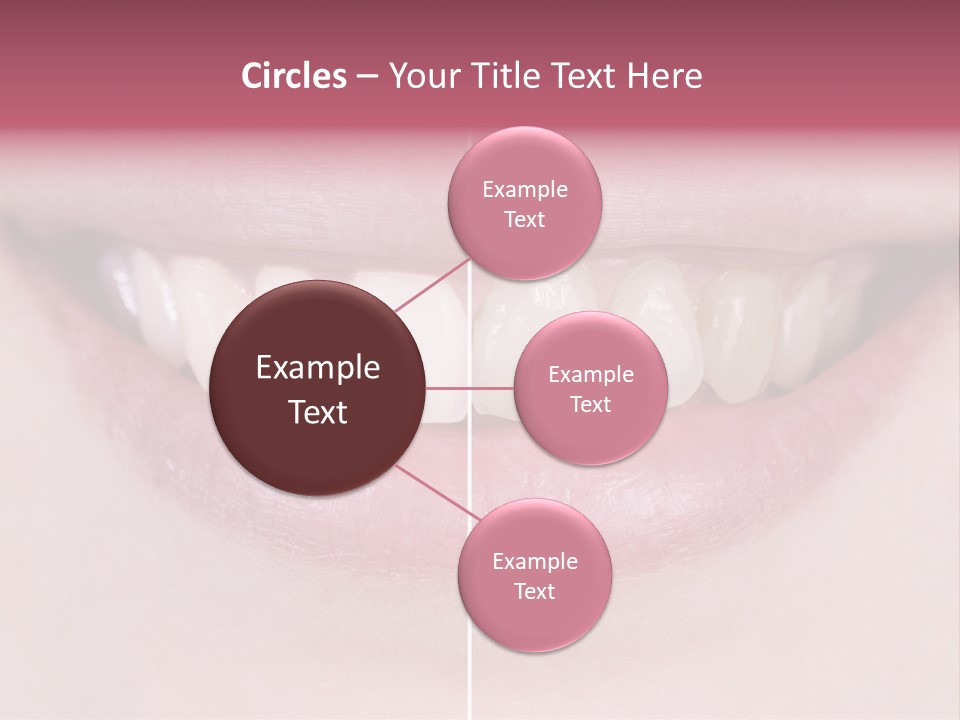 A Woman's Smile Before And After Dental Treatment PowerPoint Template