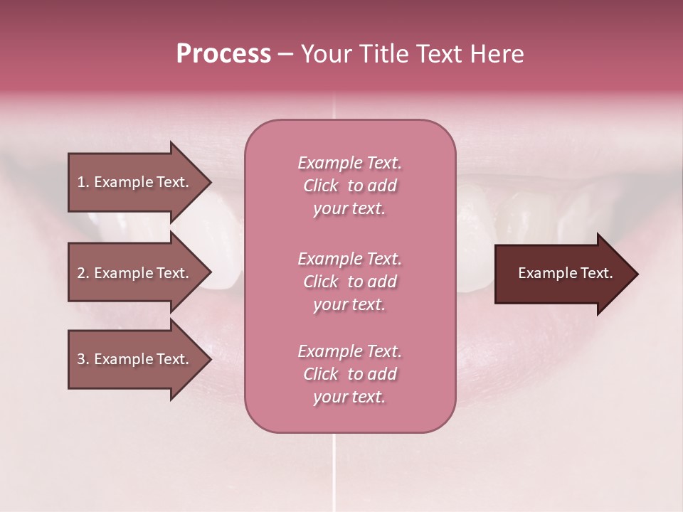 A Woman's Smile Before And After Dental Treatment PowerPoint Template
