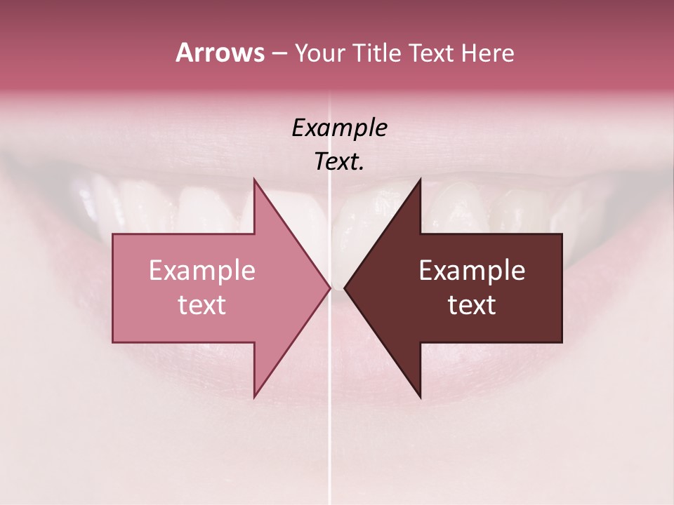 A Woman's Smile Before And After Dental Treatment PowerPoint Template