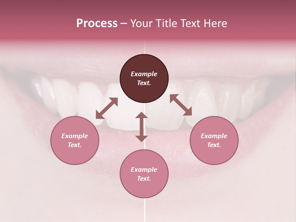 A Woman's Smile Before And After Dental Treatment PowerPoint Template