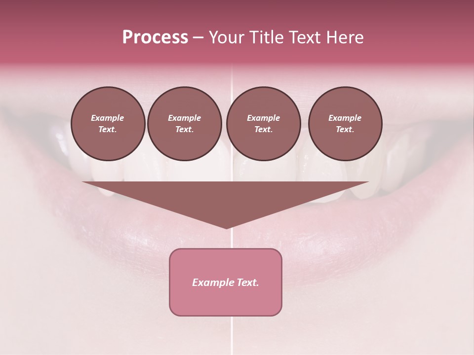 A Woman's Smile Before And After Dental Treatment PowerPoint Template