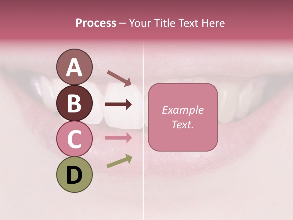 A Woman's Smile Before And After Dental Treatment PowerPoint Template