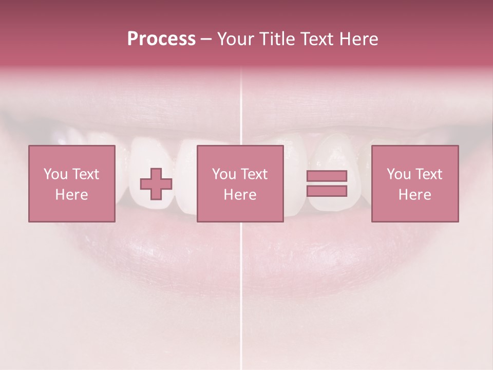 A Woman's Smile Before And After Dental Treatment PowerPoint Template