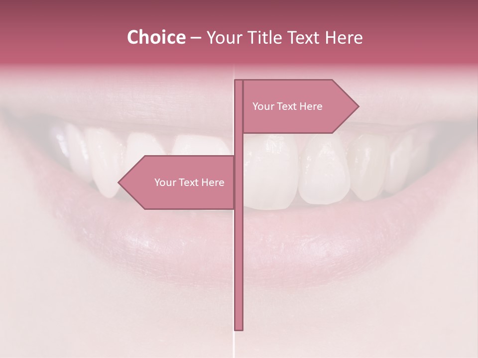A Woman's Smile Before And After Dental Treatment PowerPoint Template