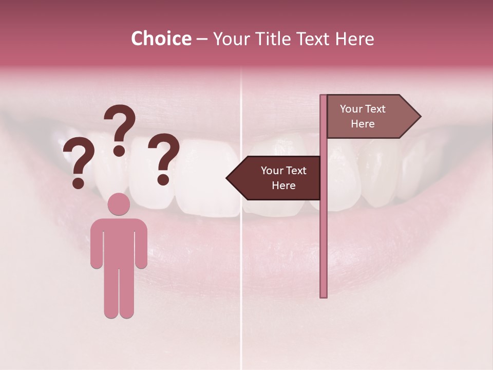 A Woman's Smile Before And After Dental Treatment PowerPoint Template