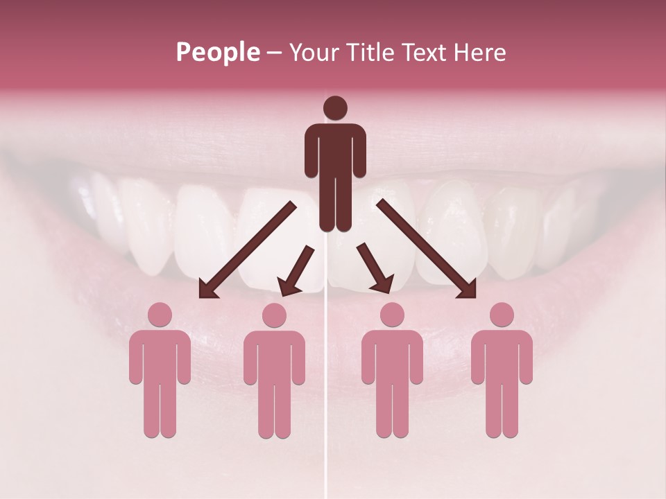 A Woman's Smile Before And After Dental Treatment PowerPoint Template