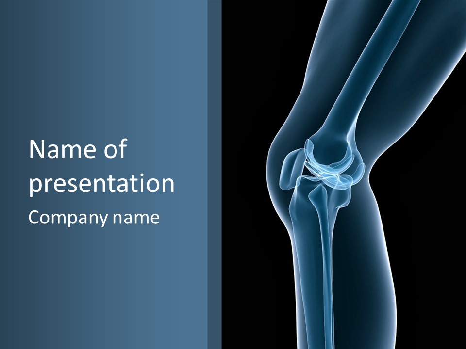 Osteoporosis Biology Backache PowerPoint Template