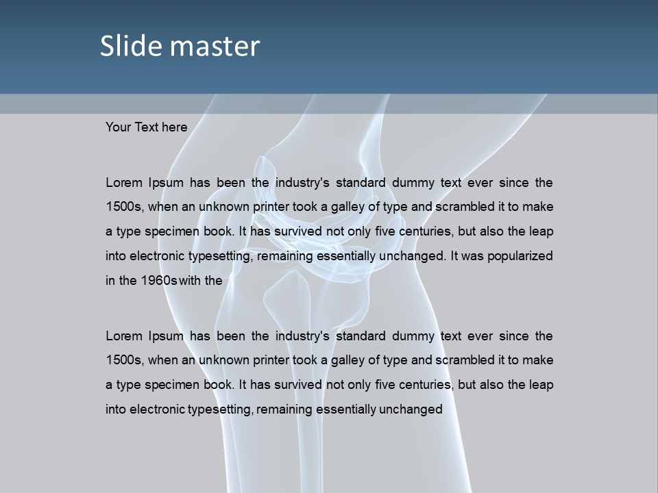 Osteoporosis Biology Backache PowerPoint Template