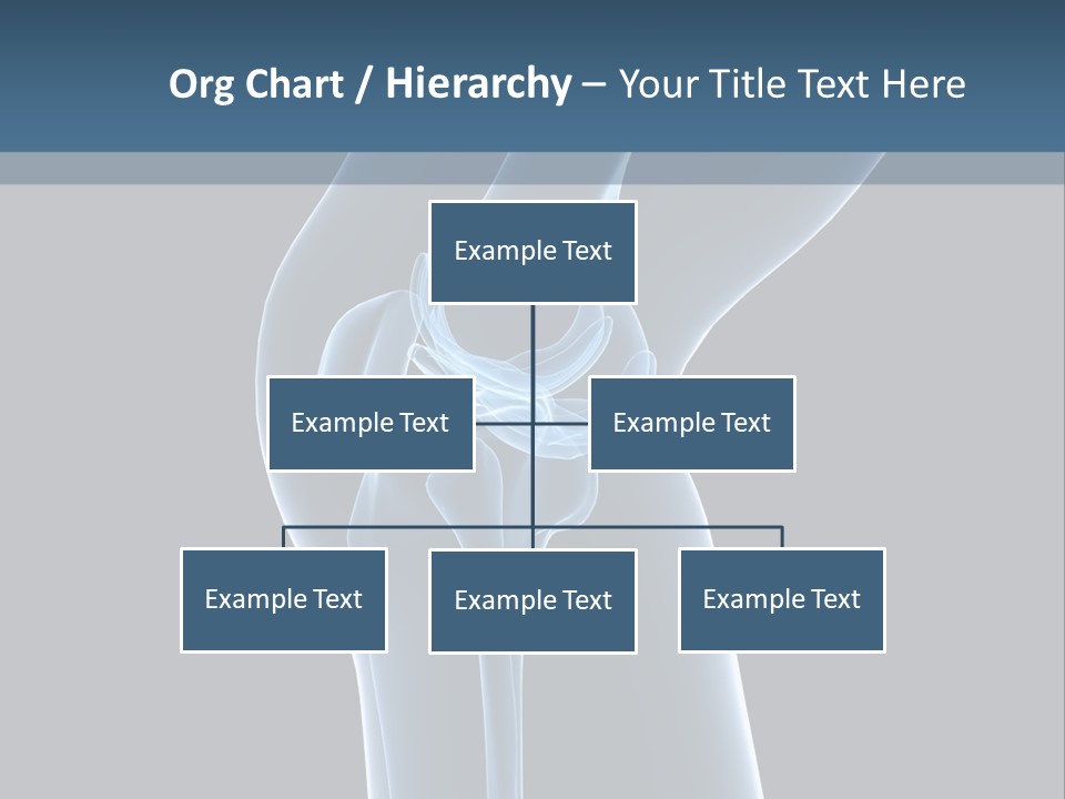 Osteoporosis Biology Backache PowerPoint Template