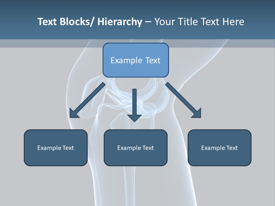 Osteoporosis Biology Backache PowerPoint Template