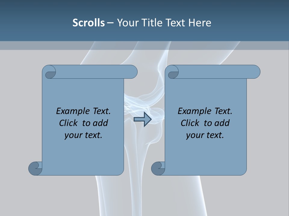 Osteoporosis Biology Backache PowerPoint Template