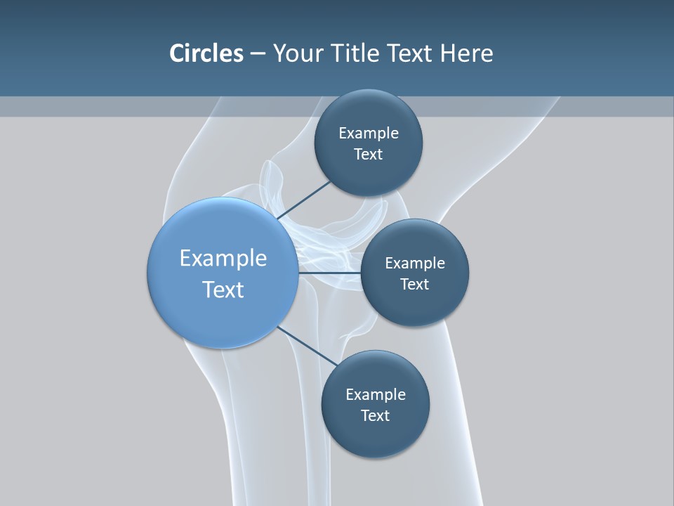 Osteoporosis Biology Backache PowerPoint Template