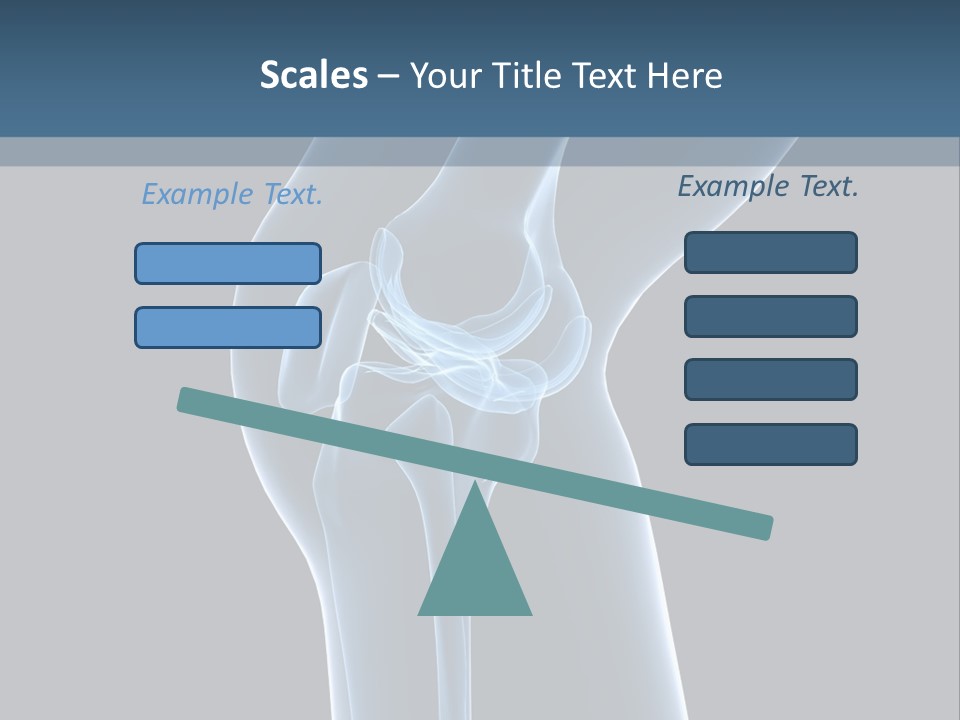 Osteoporosis Biology Backache PowerPoint Template