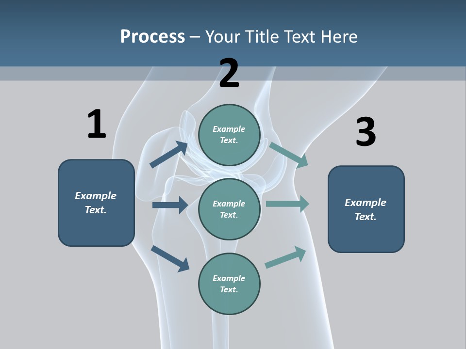 Osteoporosis Biology Backache PowerPoint Template