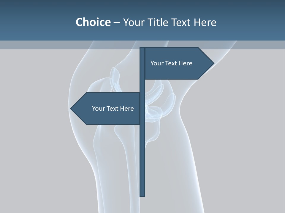 Osteoporosis Biology Backache PowerPoint Template