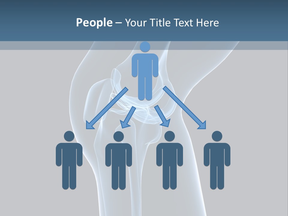 Osteoporosis Biology Backache PowerPoint Template