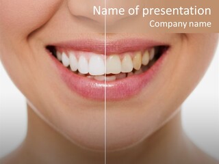 Protection Treatment Whiten PowerPoint Template