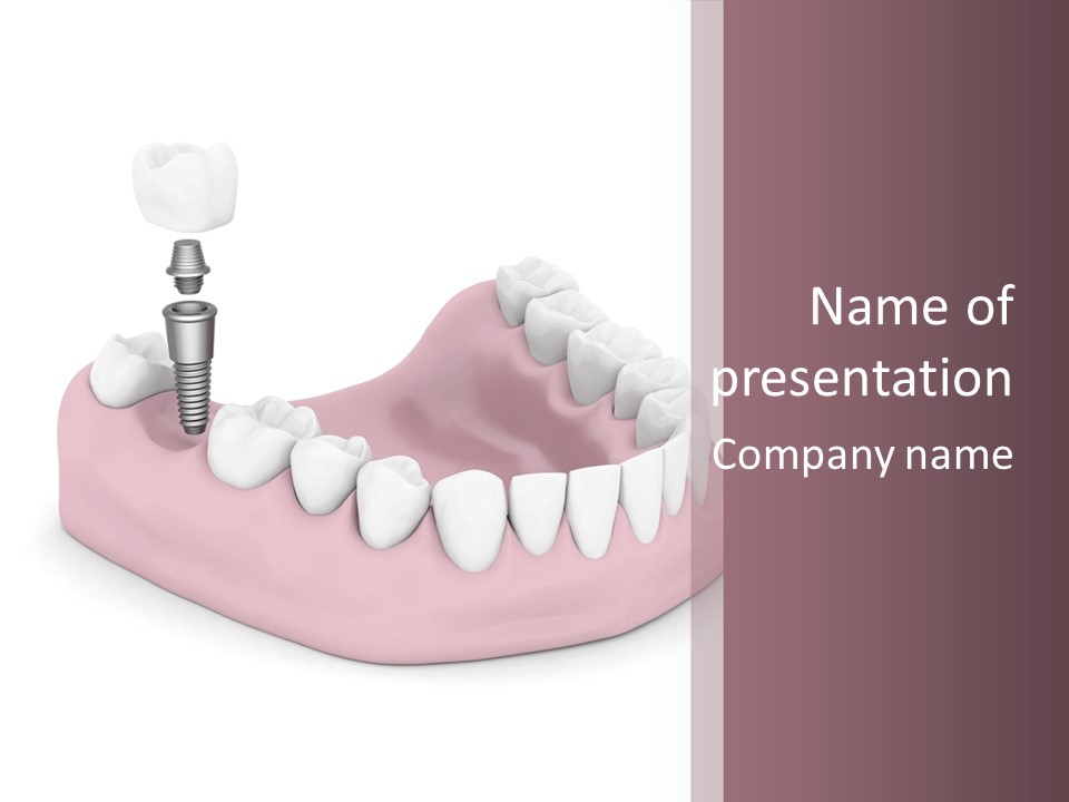 Design Dent Surgery PowerPoint Template