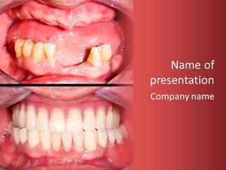 Clinic Patient Mouth PowerPoint Template