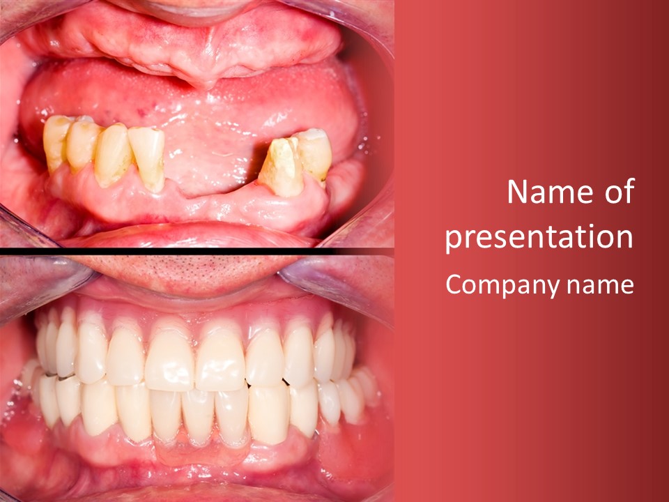 Clinic Patient Mouth PowerPoint Template