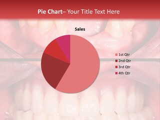 Clinic Patient Mouth PowerPoint Template