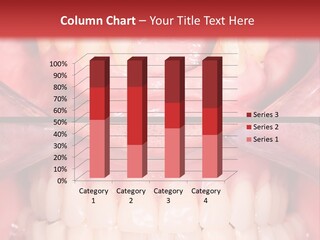 Clinic Patient Mouth PowerPoint Template