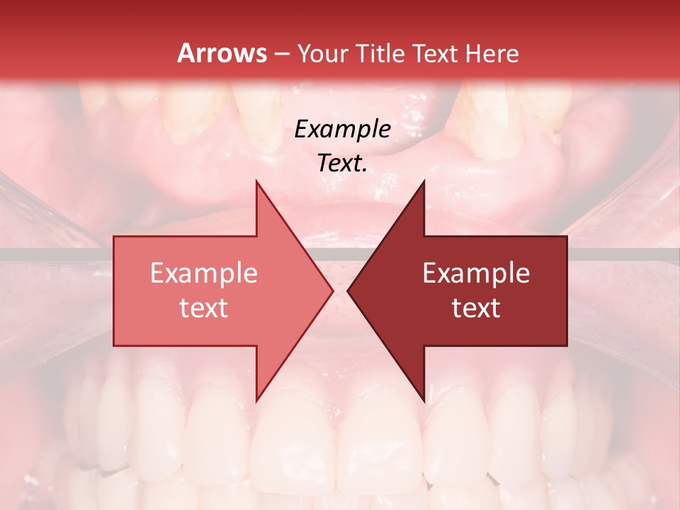 Clinic Patient Mouth PowerPoint Template