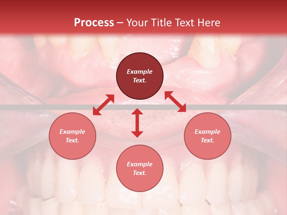 Clinic Patient Mouth PowerPoint Template