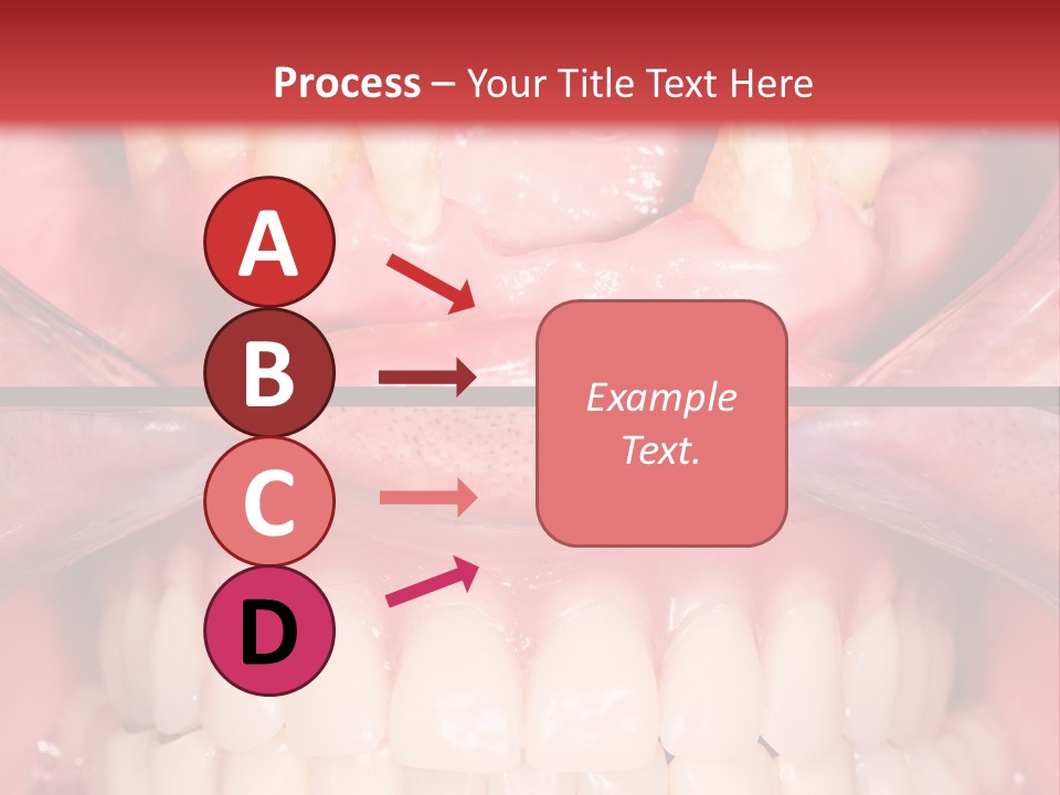 Clinic Patient Mouth PowerPoint Template