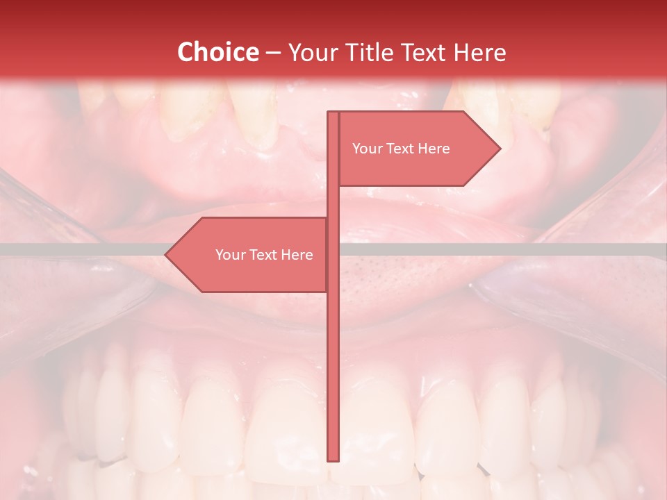 Clinic Patient Mouth PowerPoint Template