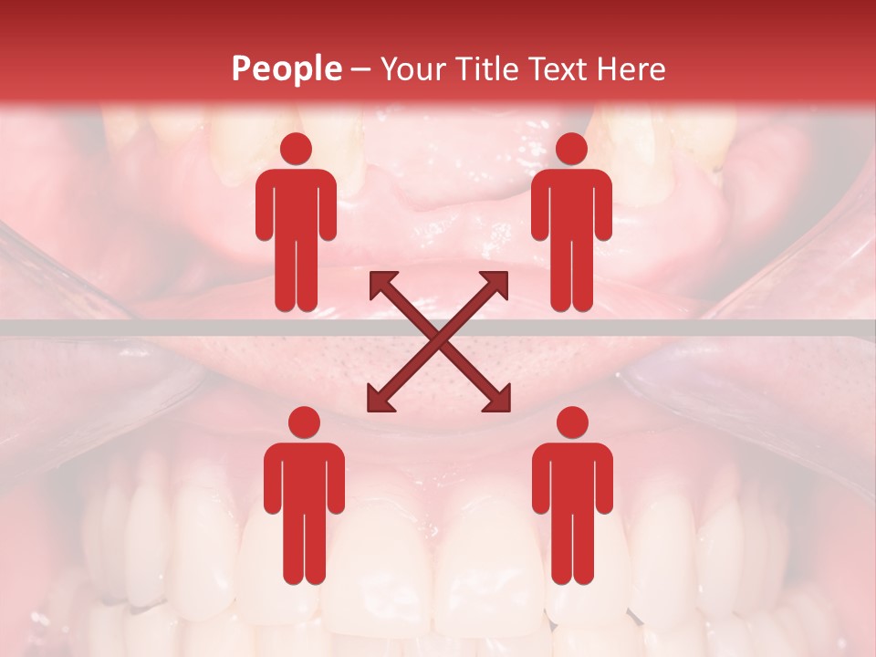 Clinic Patient Mouth PowerPoint Template