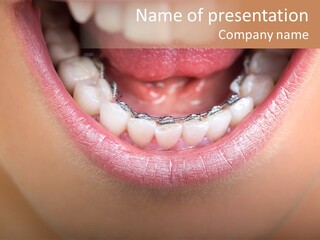 Medical Lips Healthy PowerPoint Template