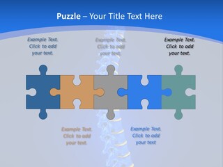 Rheumatism Slipped Disc PowerPoint Template