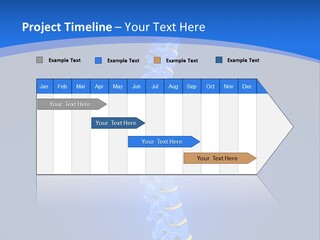 Rheumatism Slipped Disc PowerPoint Template