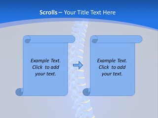 Rheumatism Slipped Disc PowerPoint Template