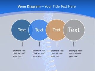 Rheumatism Slipped Disc PowerPoint Template