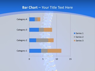 Rheumatism Slipped Disc PowerPoint Template