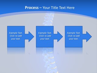 Rheumatism Slipped Disc PowerPoint Template